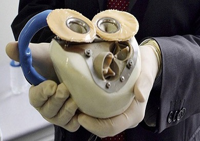 First patient leaves hospital with a total artificial heart in Sydney